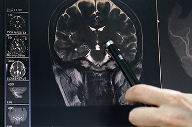 Brain MRI Scan & Clinical Diagnosis