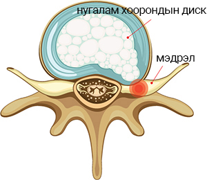 디스크 횡단면